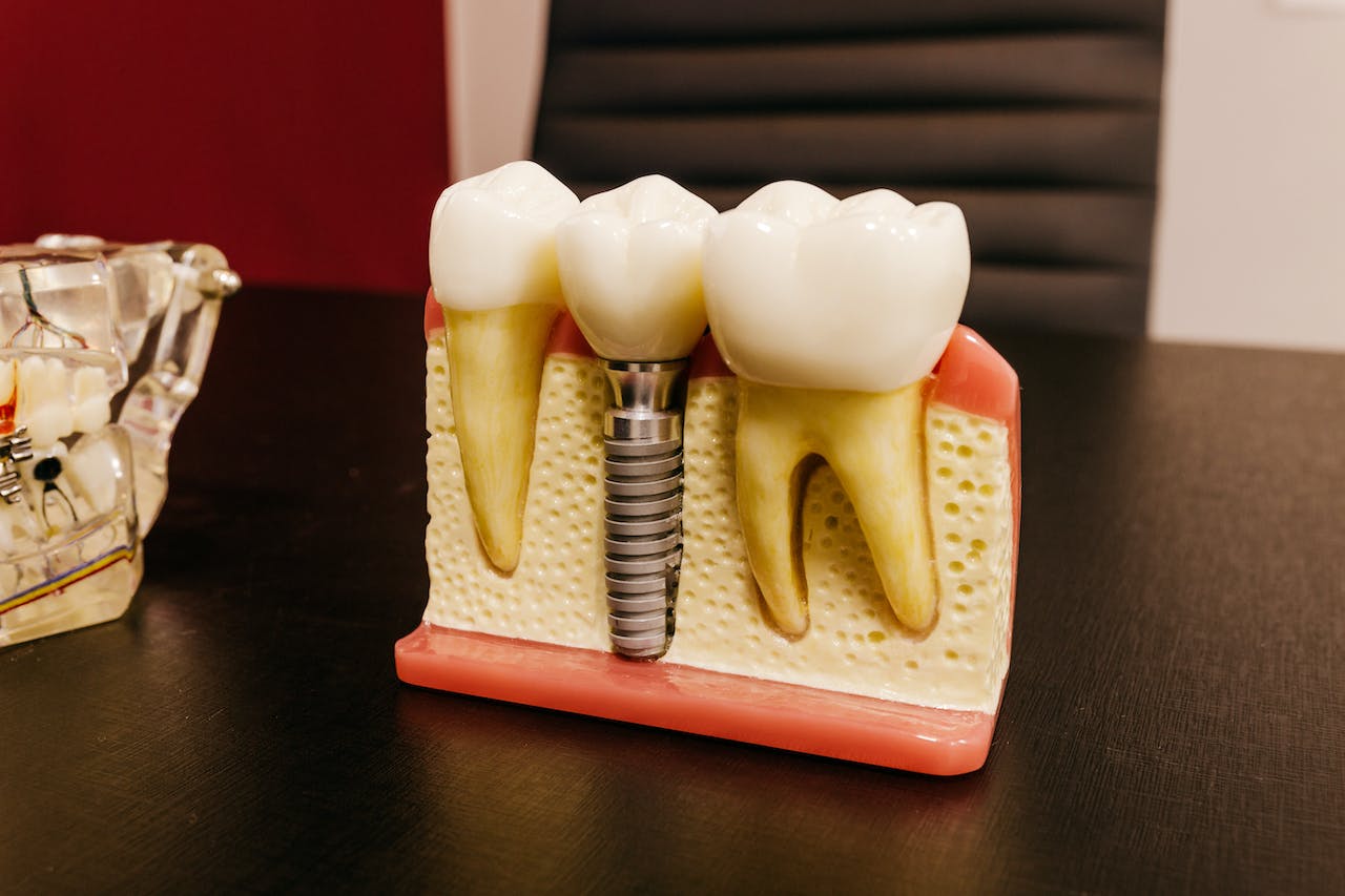 tooth 